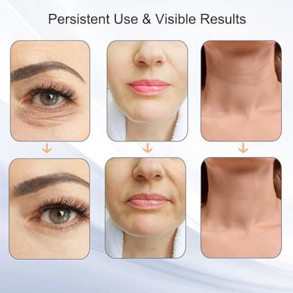 Wrinkle Remover Machine